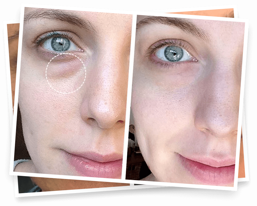 EVER SKincare New York City